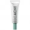 creme visage peau grasse
