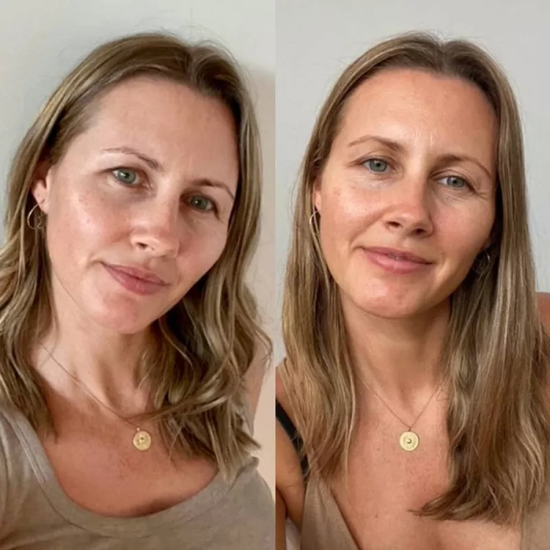 autobronzant visage